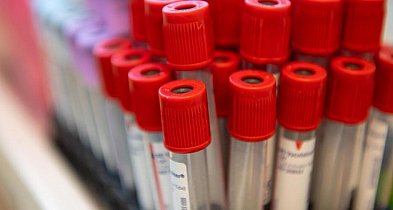 Obniżenie cholesterolu to tysiące mniej zawałów i udarów-54819