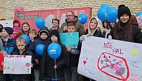 Konferencja prasowa - ZOBACZ CZYM...