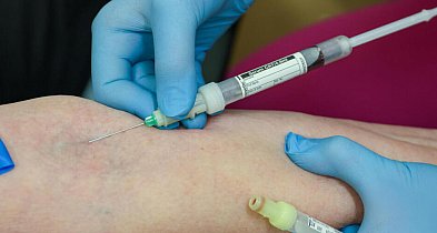 Hematolog: coraz więcej pacjentów z chorobami hematologicznymi; potrzebne zmiany s-57641